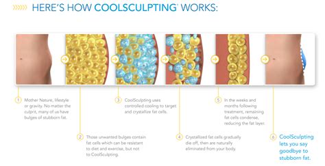 coolsculpting breckenridge|CoolSculpting: .